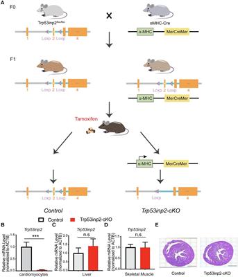 Metabolic status differentiates Trp53inp2 function in pressure-overload induced heart failure